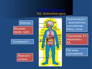 2) ATD Tricíclicos:
                 Sd. Anticoliné rgico
                                        Desorientació n
     Midriasis                          , alucinaciones,
                                        convulsiones,
 Mucosas                                fiebre, coma
 secas, rubor
                                        Taquicardia, FV,
                                        Hipotensió n,
Constipació n                           FA.

                                        Piel seca,
                                        coreoatetosis
    Retenció n
    urinaria
 