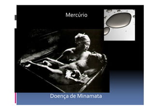 Mercúrio 
Doença de Minamata 
 