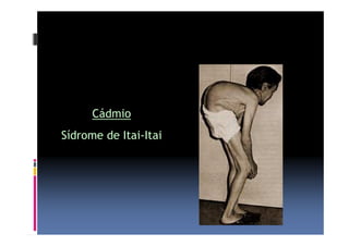 Cádmio 
Sídrome de Itai-Itai 
 