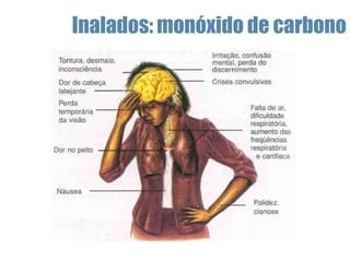 Inalados: monóxido de carbono
 