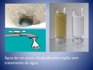 Água de um poço, rio ou de uma região sem 
tratamento de água 
 