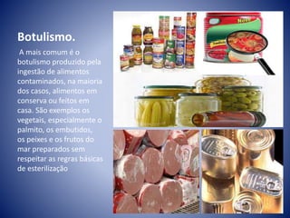 Botulismo. 
A mais comum é o 
botulismo produzido pela 
ingestão de alimentos 
contaminados, na maioria 
dos casos, alimentos em 
conserva ou feitos em 
casa. São exemplos os 
vegetais, especialmente o 
palmito, os embutidos, 
os peixes e os frutos do 
mar preparados sem 
respeitar as regras básicas 
de esterilização 
 