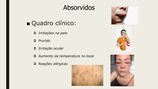 ■ Quadro clínico:
 Irritações na pele
 Prurido
 Irritação ocular
 Aumento da temperatura no local
 Reações alérgicas
Absorvidos
 