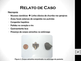 Relato de Caso
• Necropsia
  •   Mucosas cianóticas  Linha clássica de chumbo nas gengivas
  •   Áreas focais extensas de congestão nos pulmões
  •   Congestão hepática
  •   Palidez no coração e rins
  •   Gastroenterite leve
  •   Presença de corpos estranhos no estômago




                                                                           27


          Figura 2. Corpos estranhos encontrados no estômago do paciente
 