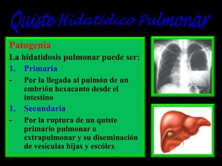 Patogenia
La hidatidosis pulmonar puede ser:
1. Primaria
- Por la llegada al pulmón de un
embrión hexacanto desde el
intestino

1. Secundaria
- Por la ruptura de un quiste
primario pulmonar o
extrapulmonar y su diseminación
de vesículas hijas y escólex

 