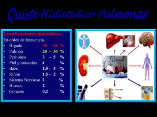 Localizaciones hidatídicas
En orden de frecuencia.
• Hígado
50 –
• Pulmón
20 –
• Peritoneo
3 –
• Piel y músculos 4
• Bazo
1,5 –
• Riñón
1.5 –
• Sistema Nervioso 2
• Huesos
2
• Corazón
0,2

60 %
30 %
5 %
%
3 %
2 %
%
%
%

 