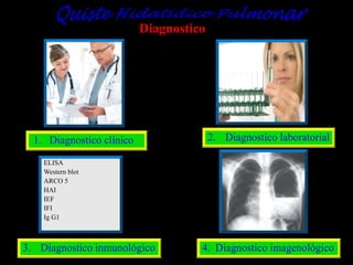 Diagnostico

1. Diagnostico clínico

2. Diagnostico laboratorial

ELISA
Western blot
ARCO 5
HAI
IEF
IFI
Ig G1

3. Diagnostico inmunológico

4. Diagnostico imagenológico

 