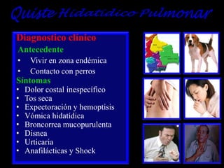 Diagnostico clínico
Antecedente
•
•

Vivir en zona endémica
Contacto con perros

Síntomas
•
•
•
•
•
•
•
•

Dolor costal inespecífico
Tos seca
Expectoración y hemoptisis
Vómica hidatídica
Broncorrea mucopurulenta
Disnea
Urticaria
Anafilácticas y Shock

 