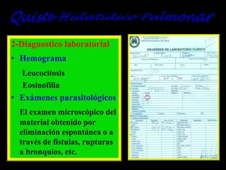 2-Diagnostico laboratorial
• Hemograma
Leucocitosis
Eosinofilia

• Exámenes parasitológicos
El examen microscópico del
material obtenido por
eliminación espontánea o a
través de fístulas, rupturas
a bronquios, etc.

 