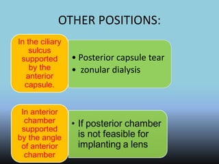 OTHER POSITIONS:
• Posterior capsule tear
• zonular dialysis
 