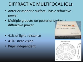 DIFFRACTIVE MULTIFOCAL IOLs
• Anterior aspheric surface : basic refractive
power
• Multiple grooves on posterior surface :
diffractive power
• 41% of light : distance
• 41% : near vision
• Pupil independent
 