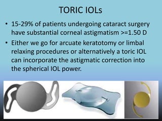 TORIC IOLs
• 15-29% of patients undergoing cataract surgery
have substantial corneal astigmatism >=1.50 D
• Either we go for arcuate keratotomy or limbal
relaxing procedures or alternatively a toric IOL
can incorporate the astigmatic correction into
the spherical IOL power.
 