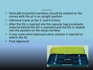 ……..
• Vertical& horizontal meridians should be marked on the
cornea with the pt in an upright position.
• reference marks at the 3- and 9-o’clock
• After the IOL is injected into the capsular bag viscoelastic
material behind the IOL is aspirated and the IOL is rotated
into the position on the steep meridian
• It may roate when balanced saline solution is injected to
reform the AC
• Final alignment
 
