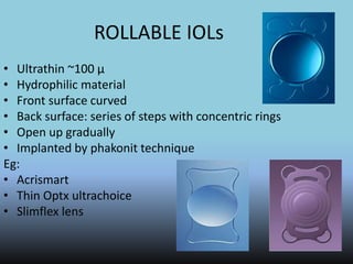 ROLLABLE IOLs
• Ultrathin ~100 µ
• Hydrophilic material
• Front surface curved
• Back surface: series of steps with concentric rings
• Open up gradually
• Implanted by phakonit technique
Eg:
• Acrismart
• Thin Optx ultrachoice
• Slimflex lens
 