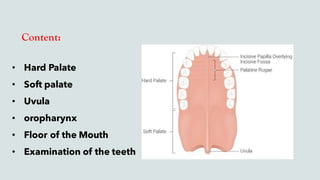 Content:
• Hard Palate
• Soft palate
• Uvula
• oropharynx
• Floor of the Mouth
• Examination of the teeth
 