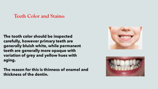 Teeth Color and Stains:
The tooth color should be inspected
carefully, however primary teeth are
generally bluish white, while permanent
teeth are generally more opaque with
variation of grey and yellow hues with
aging.
The reason for this is thinness of enamel and
thickness of the dentin.
 