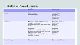 Healthy vs Diseased Gingiva:
 