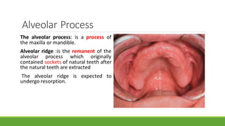 Intra-oral Anatomical Landmarks Related to Removable Prostheses.pdf