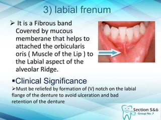 3) labial frenum
 It is a Fibrous band
Covered by mucous
memberane that helps to
attached the orbicularis
oris ( Muscle of the Lip ) to
the Labial aspect of the
alveolar Ridge.
Clinical Significance
Must be reliefed by formation of (V) notch on the labial
flange of the denture to avoid ulceration and bad
retention of the denture
 