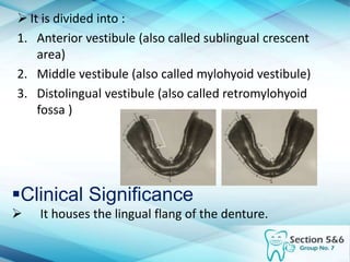  It is divided into :
1. Anterior vestibule (also called sublingual crescent
area)
2. Middle vestibule (also called mylohyoid vestibule)
3. Distolingual vestibule (also called retromylohyoid
fossa )
Clinical Significance
 It houses the lingual flang of the denture.
 