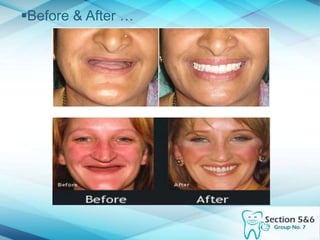 Before & After …
 