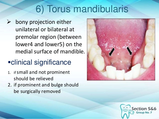 intra oral mandibular landmarks