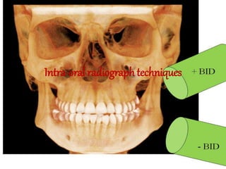 Intra-oral radiograph techniques
 