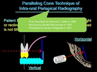 Paralleling Cone Technique of
Intra-oral Periapical Radiography
Patient Position: Patient can be either sitting upright
or reclined in the dental chair provided that the head
is not tilted to the side.
•First described by Edmund C. Kells in 1896
•Revived by Donald McCormack in 1937
•Perfected by Gordon Fitzgerald in 1947
Vertical
Horizontal
 