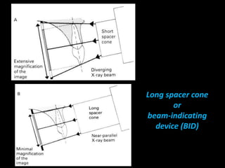 Long spacer cone
or
beam-indicating
device (BID)
 
