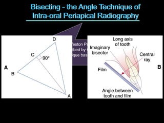Bisecting - the Angle Technique of
Intra-oral Periapical Radiography
•First described by Weston Price in 1904
•Independently described by Cieszynski in 1907
•Also called as technique based on Principle of Isometric
Triangulation
 