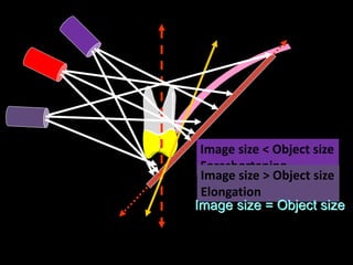 Image size < Object size
Foreshortening
Image size > Object size
Elongation
Image size = Object size
 