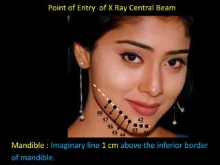 41
42
43
47
48
44
46
45
Point of Entry of X Ray Central Beam
Mandible : Imaginary line 1 cm above the inferior border
of mandible.
 