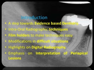 Objectives of the presentation
• A step towards Evidence based Dentistry.
• Intra-Oral Radiographic techniques
• Film holders to make techniques easy.
• Modifications in difficult situations
• Highlights on Digital Radiography.
• Emphasis on Interpretation of Periapical
Lesions
Introduction
 