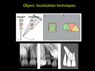 Object localization techniques
 