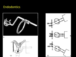 Endodontics
 