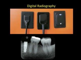 Digital Radiography
 