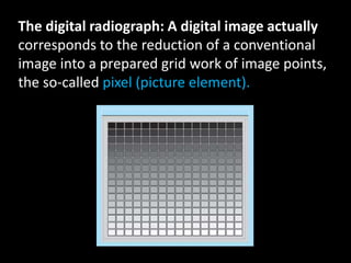 The digital radiograph: A digital image actually
corresponds to the reduction of a conventional
image into a prepared grid work of image points,
the so-called pixel (picture element).
 