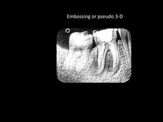 Embossing or pseudo 3-D
 