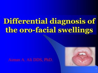 Differential diagnosis of
the oro-facial swellings
Aiman A. Ali DDS, PhD.
1
 