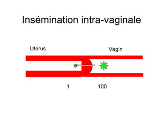 Insémination intra-vaginale Uterus Vagin 100 1 