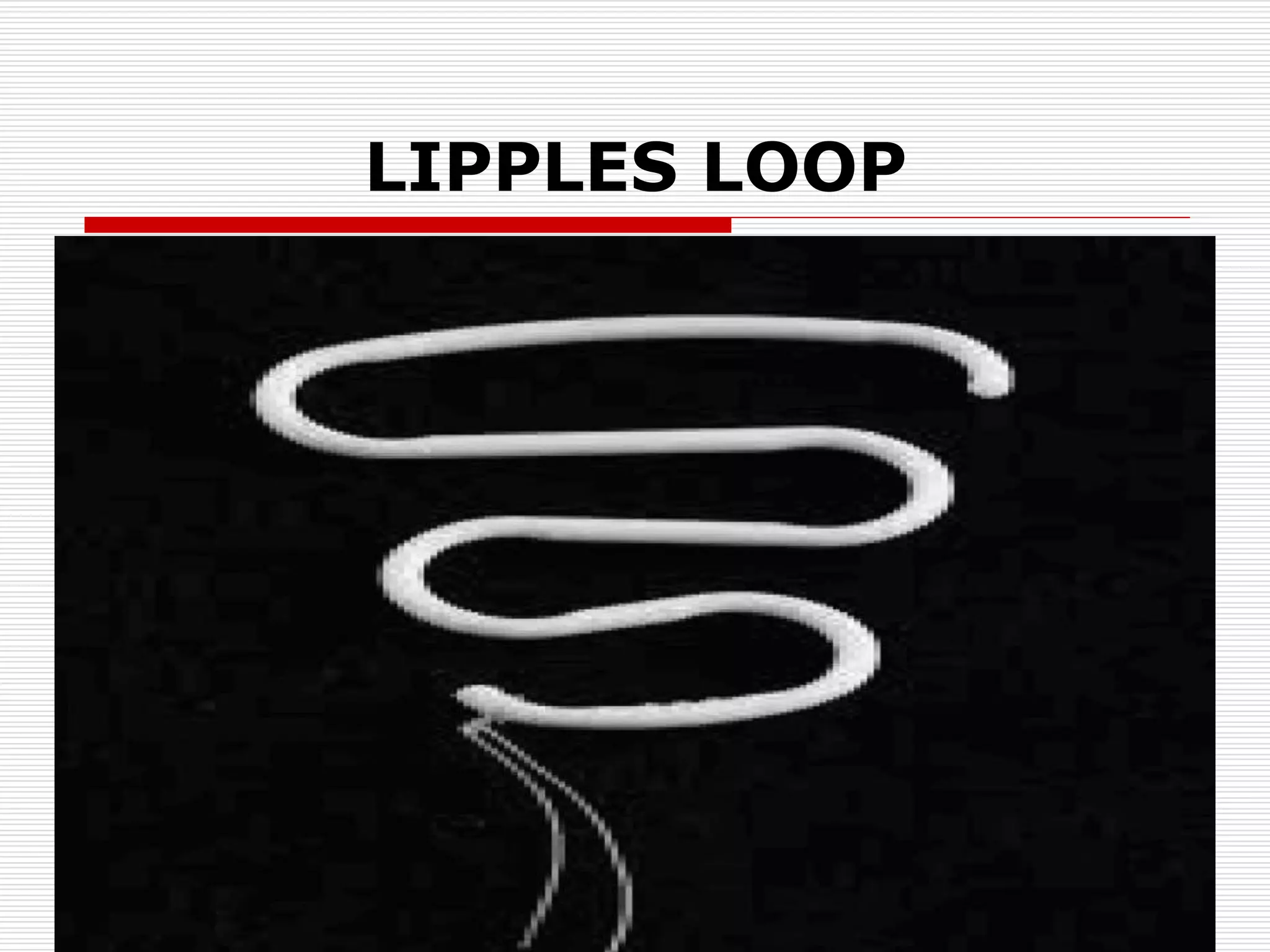 LIPPLES LOOP
 
