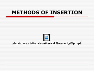 METHODS OF INSERTION
 