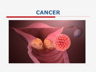 CANCER
 