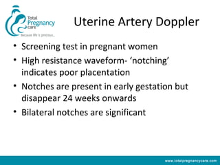 Uterine Artery Doppler
• Screening test in pregnant women
• High resistance waveform- ‘notching’
  indicates poor placentation
• Notches are present in early gestation but
  disappear 24 weeks onwards
• Bilateral notches are significant



                                      www.totalpregnancycare.com
 