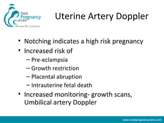 Uterine Artery Doppler

• Notching indicates a high risk pregnancy
• Increased risk of
  – Pre-eclampsia
  – Growth restriction
  – Placental abruption
  – Intrauterine fetal death
• Increased monitoring- growth scans,
  Umbilical artery Doppler

                                   www.totalpregnancycare.com
 