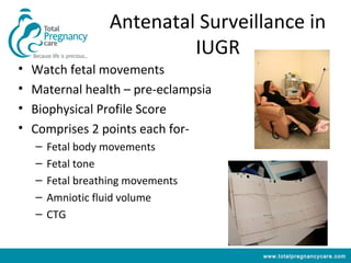 Antenatal Surveillance in
                             IUGR
•   Watch fetal movements
•   Maternal health – pre-eclampsia
•   Biophysical Profile Score
•   Comprises 2 points each for-
    –   Fetal body movements
    –   Fetal tone
    –   Fetal breathing movements
    –   Amniotic fluid volume
    –   CTG


                                      www.totalpregnancycare.com
 