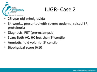 IUGR- Case 2
• 25 year old primigravida
• 34 weeks, presented with severe oedema, raised BP,
  proteinuria
• Diagnosis: PET (pre-eclampsia)
• Scan: Both AC, HC less than 3rd centile
• Amniotic fluid volume: 5th centile
• Biophysical score 6/10




                                          www.totalpregnancycare.com
 