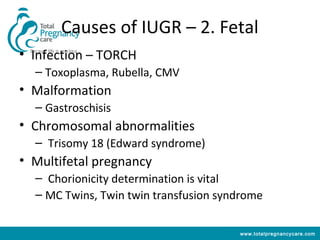 Causes of IUGR – 2. Fetal
• Infection – TORCH
  – Toxoplasma, Rubella, CMV
• Malformation
  – Gastroschisis
• Chromosomal abnormalities
  – Trisomy 18 (Edward syndrome)
• Multifetal pregnancy
  – Chorionicity determination is vital
  – MC Twins, Twin twin transfusion syndrome

                                       www.totalpregnancycare.com
 