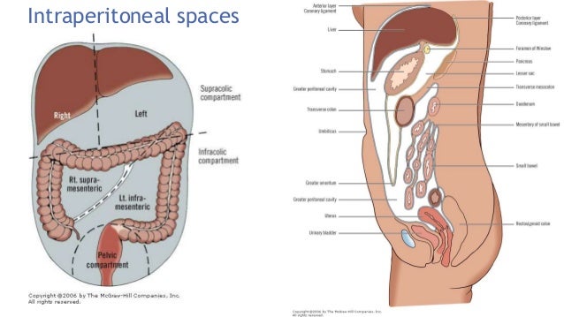 Intra abdominal abscess Intra abdominal abscess
