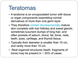 Teratomas
 A teratoma is an encapsulated tumor with tissue
or organ components resembling normal
derivatives of more than one germ layer
 They therefore contain developmentally mature
skin complete with hair follicles and sweat glands,
sometimes luxuriant clumps of long hair, and
often pockets of sebum, blood, fat, bone, nails,
teeth, eyes, cartilage, and thyroid tissue.
 Typically their diameter is smaller than 10 cm,
and rarely more than 15 cm.
 Real organoid structures (teeth, fragments of
bone) may be present in ~ 30% of cases.
 